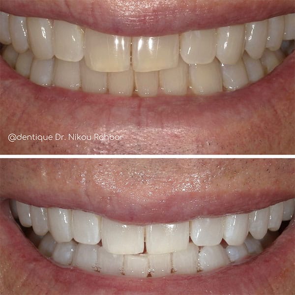 kor-whitening